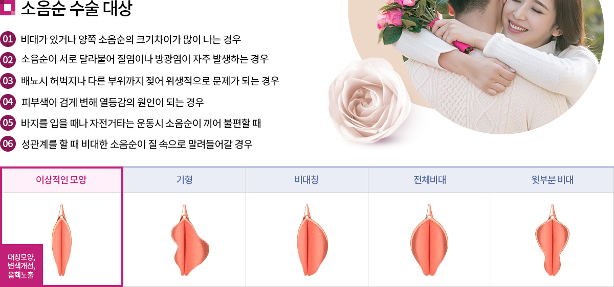    : (01) 밡 ְų   ṵ̃    (02)   ޶پ ̳ 汤  ߻ϴ  (03) 财  ٸ     Ǵ  (04) Ǻλ ˰    Ǵ  (05)    Ÿ      (06) 踦        